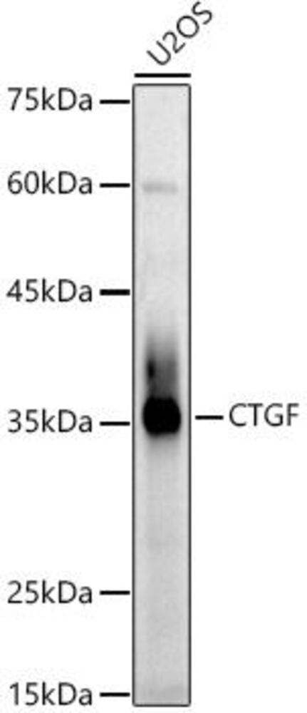 Anti-CTGF Antibody