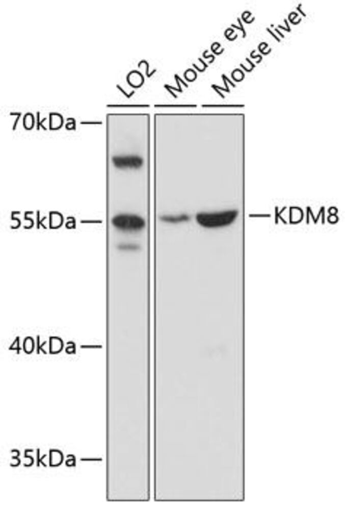Anti-JMJD5 Antibody, 100 µl