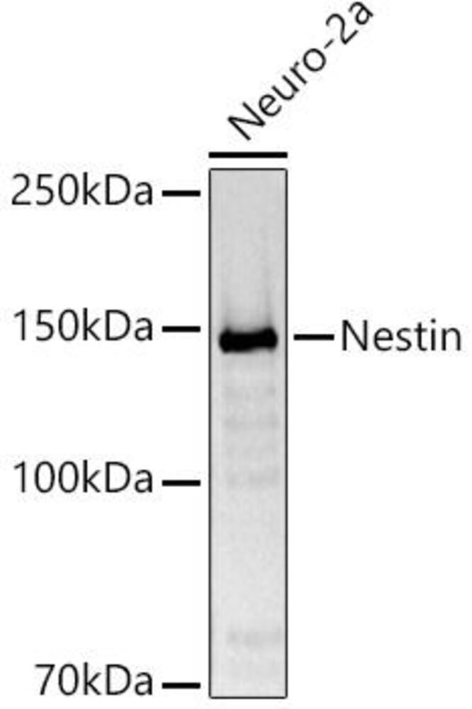 Anti-Nestin Antibody
