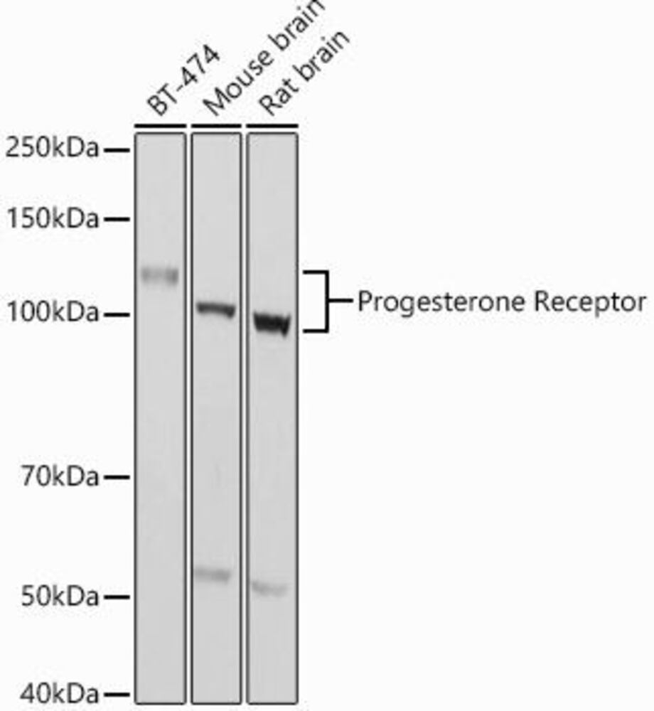 Anti-progesterone receptor antibody, 100 µl