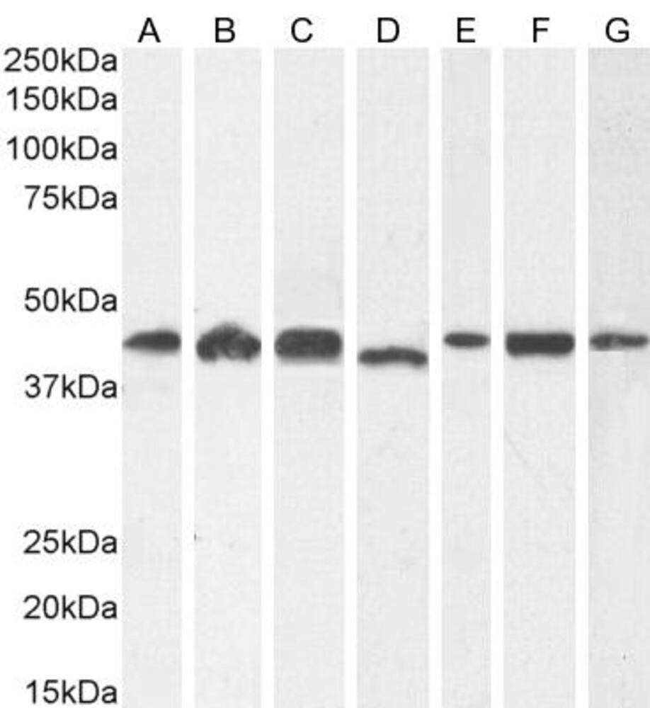 Anti-ARP1 Antibody, 100 µg