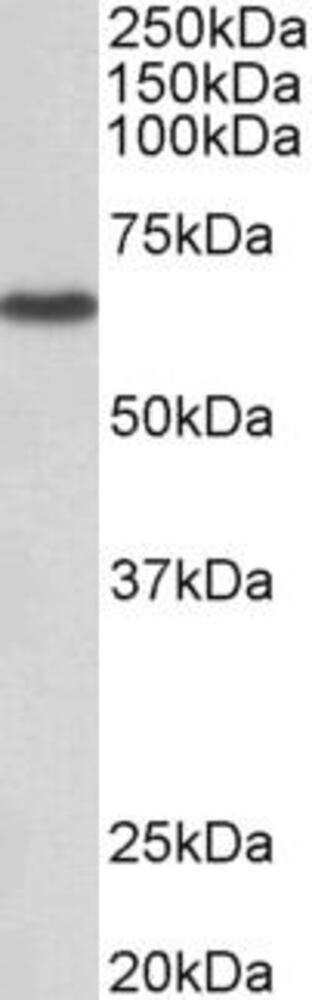 Anti-STK3 Antibody, 100 µg