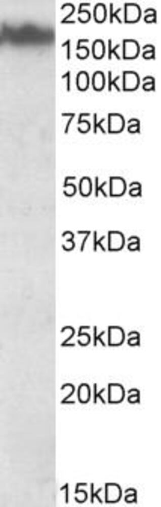 Anti-160 kD Neurofilament Medium Antibody