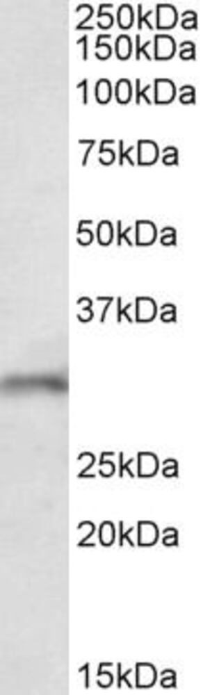 Anti-FGF14 Antibody
