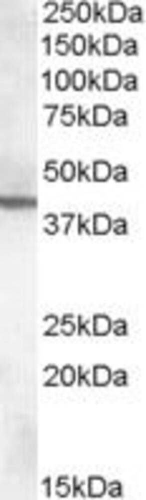 Anti-ABHD12 Antibody, 100 µg