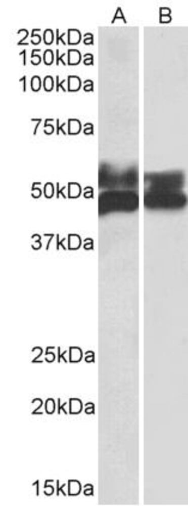 Anti-FCRL1 Antibody, 100 µg
