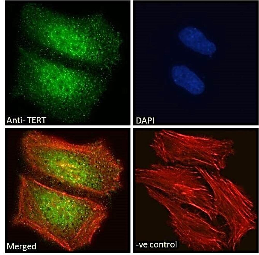 Anti-Telomerase Reverse Transcriptase Antibody