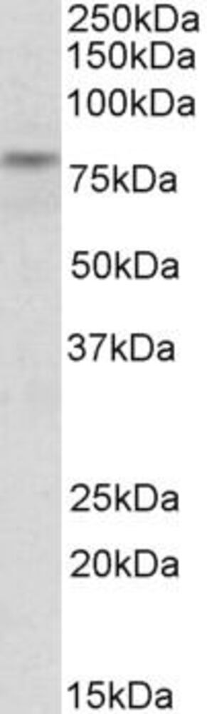 Anti-TRIM2 Antibody, 100 µg