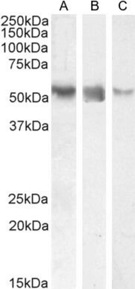 Anti-ROR gamma Antibody, 100 µg