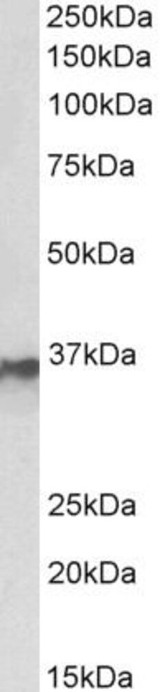 Anti-hnRNP A2B1 antibody, 100 µg