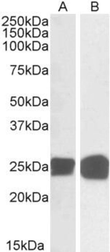 Anti-GRB2 Antibody, 100 µg