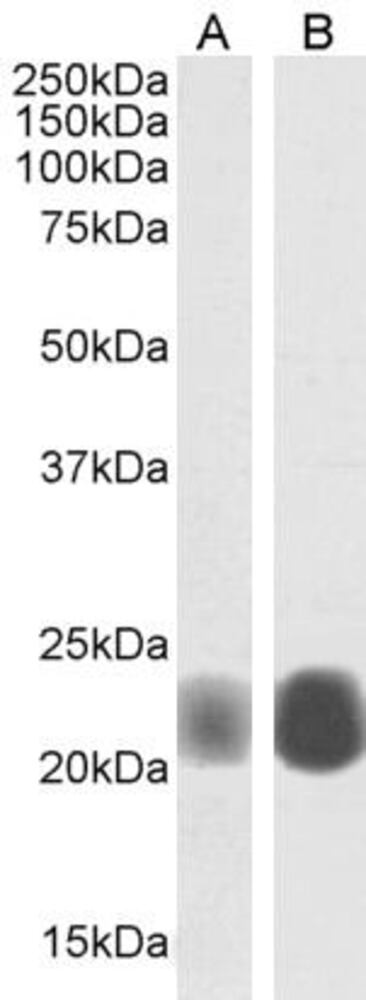 Anti-Caveolin-1 Antibody, 100 µg