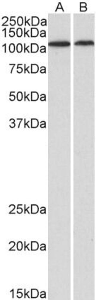 Anti-BMP1/PCP Antibody