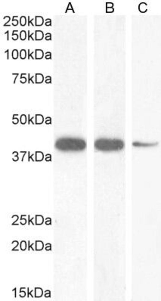 Anti-Nkx2.5 Antibody, 100 µg