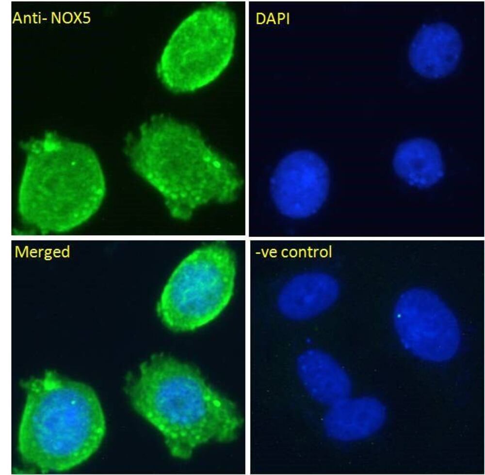 Anti-NOX5 Antibody, 100 µg