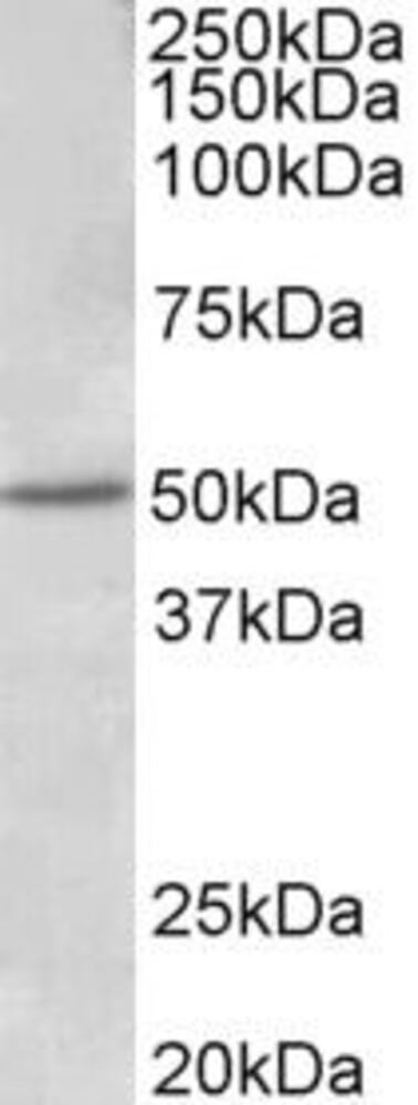 Anti-Estrogen Receptor beta Antibody, 100 µg