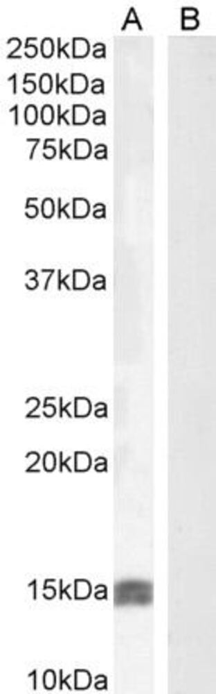 Anti-IGF1 Antibody, 100 µg