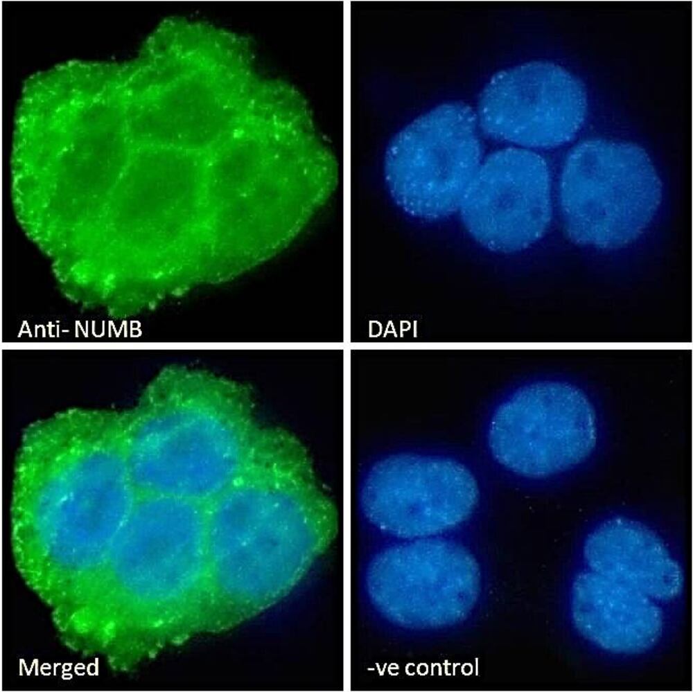 Anti-NUMB Antibody, 100 µg