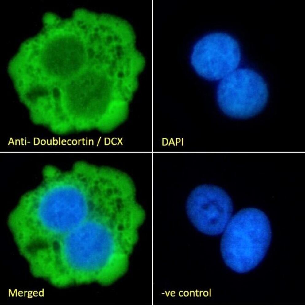 Anti-Doublecortin Antibody, 100 µg