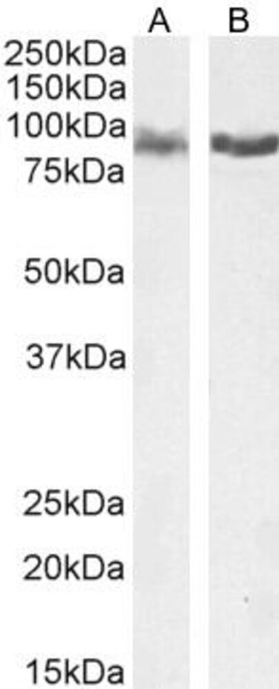 Anti-IFT88 Antibody, 100 µg