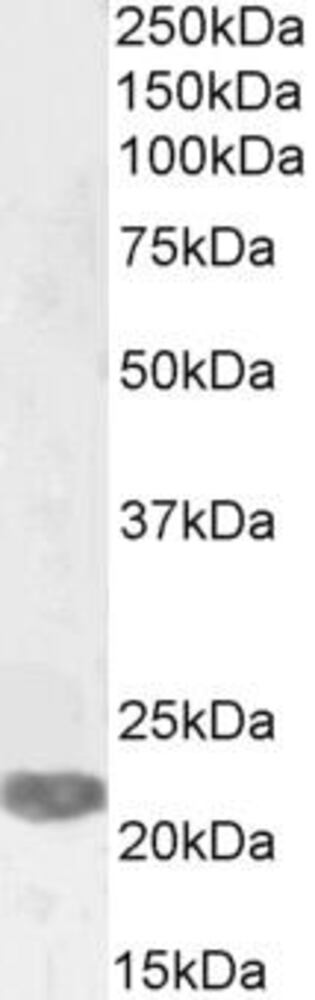 Anti-PRX-1 Antibody, 100 µg