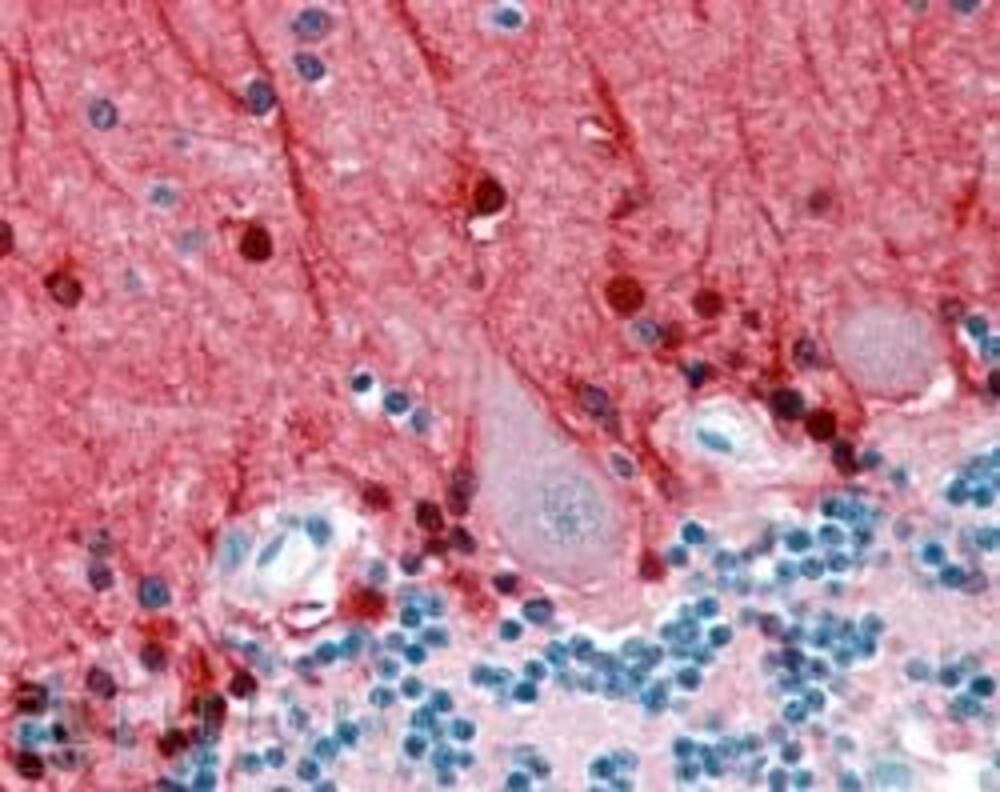 Anti-Amphiphysin Antibody, 100 µg