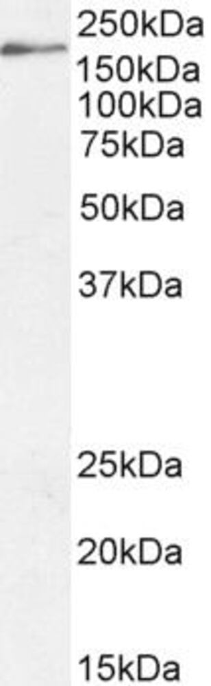Anti-Dscam Antibody, 100 µg