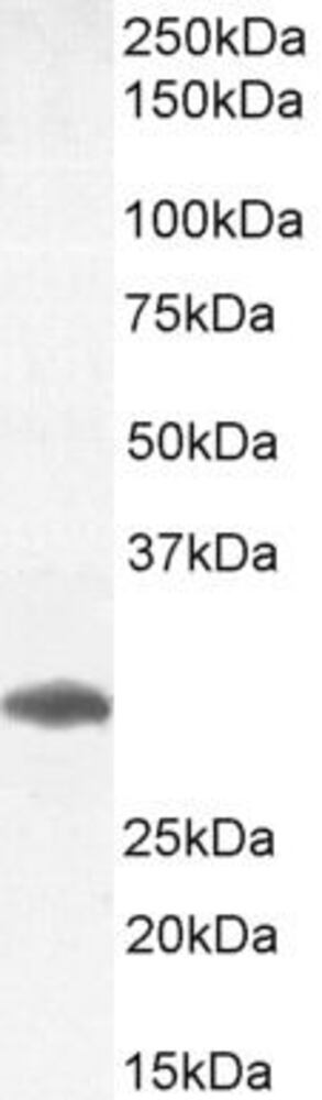Anti-FOXI1 Antibody, 100 µg