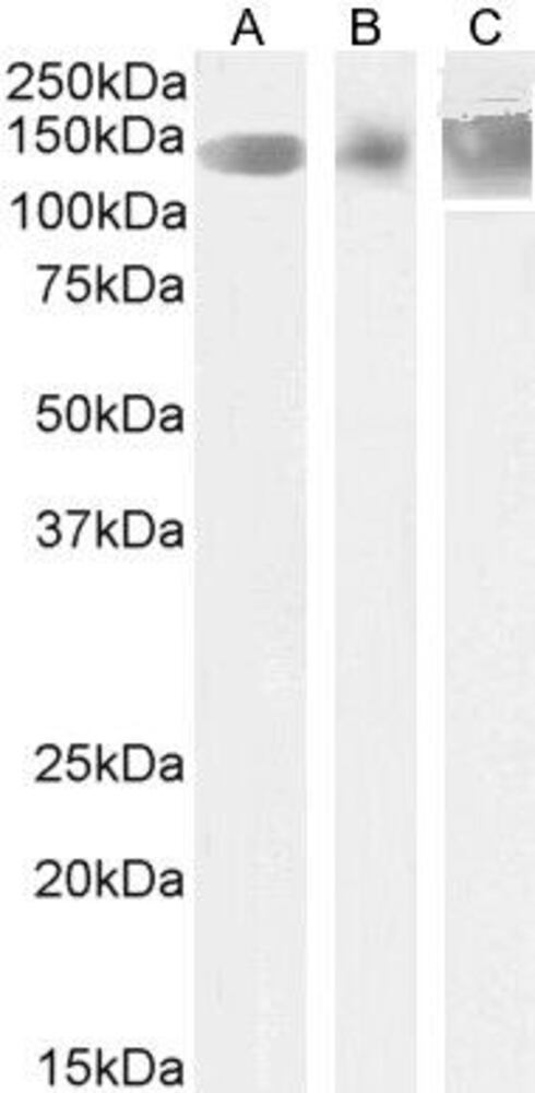 Anti-Leptin Receptor Antibody, 100 µg