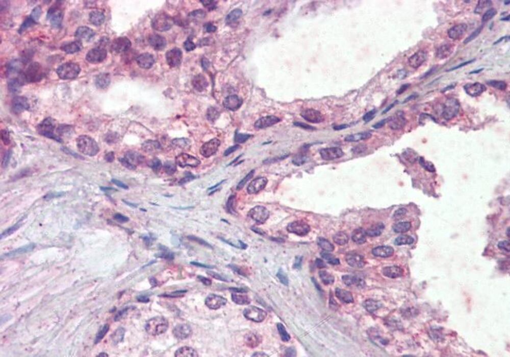 Anti-IFNAR2 Antibody, 100 µg
