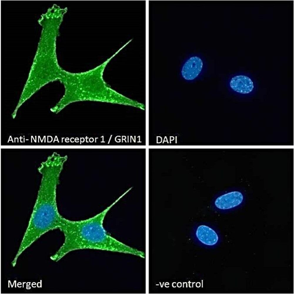 Anti-NMDAR1 Antibody, 100 µg