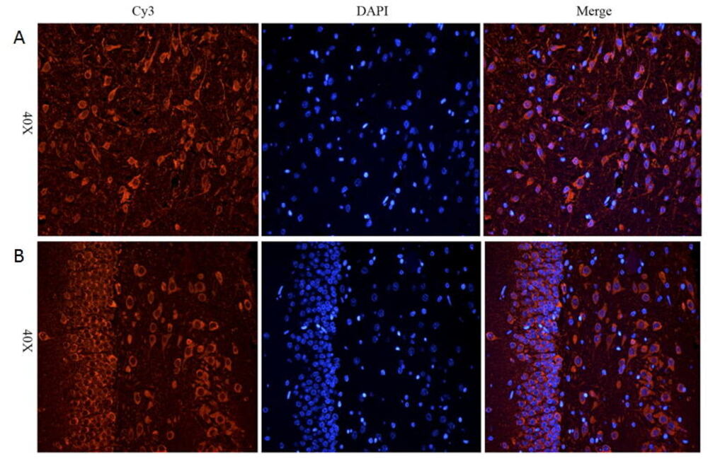 Anti-CHRNA7 Antibody, 100 µg