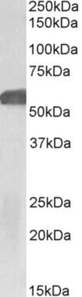 Anti-GLP-1R Antibody
