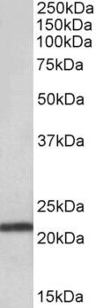Anti-TMEM205 Antibody, 100 µg