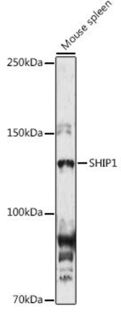 Anti-SHIP-1 Antibody, 100 µl