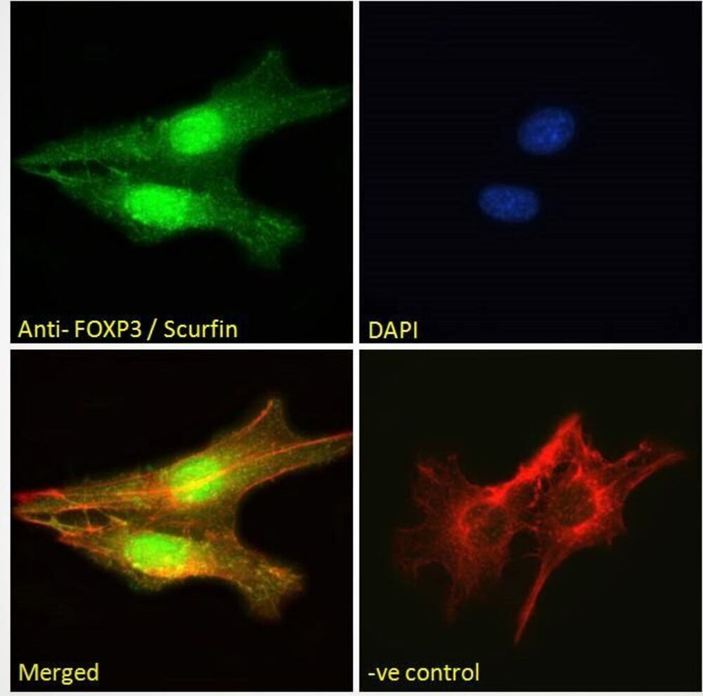 Anti-FOXP3 Antibody, 100 µg