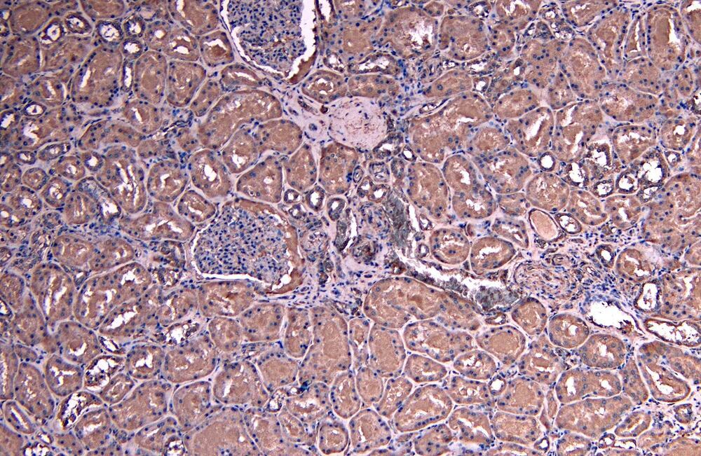Anti-SOCS1 Antibody, 100 µg