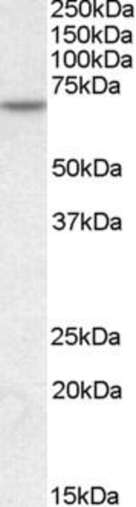 Anti-MTM1 Antibody, 100 µg