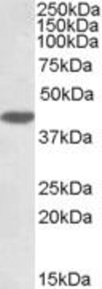 Anti-MKP-1 Antibody, 100 µg