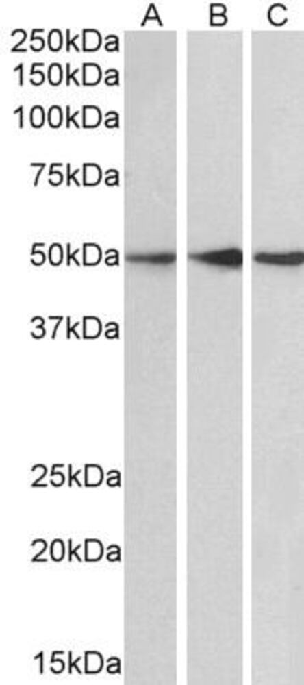 Anti-PPP2R5E Antibody, 100 µg