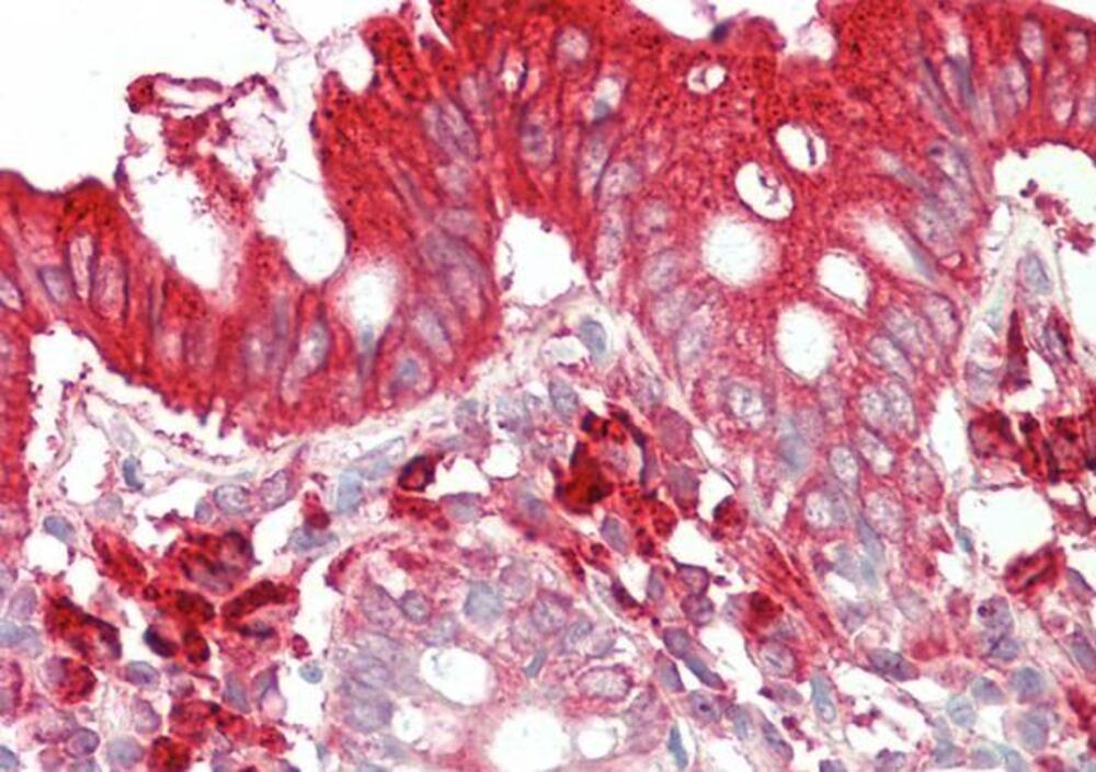 Anti-TFB2M Antibody, 100 µg