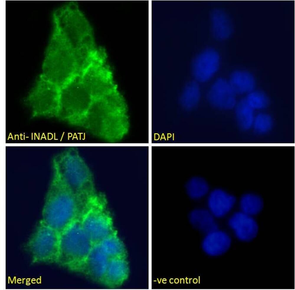 Anti-PATJ Antibody