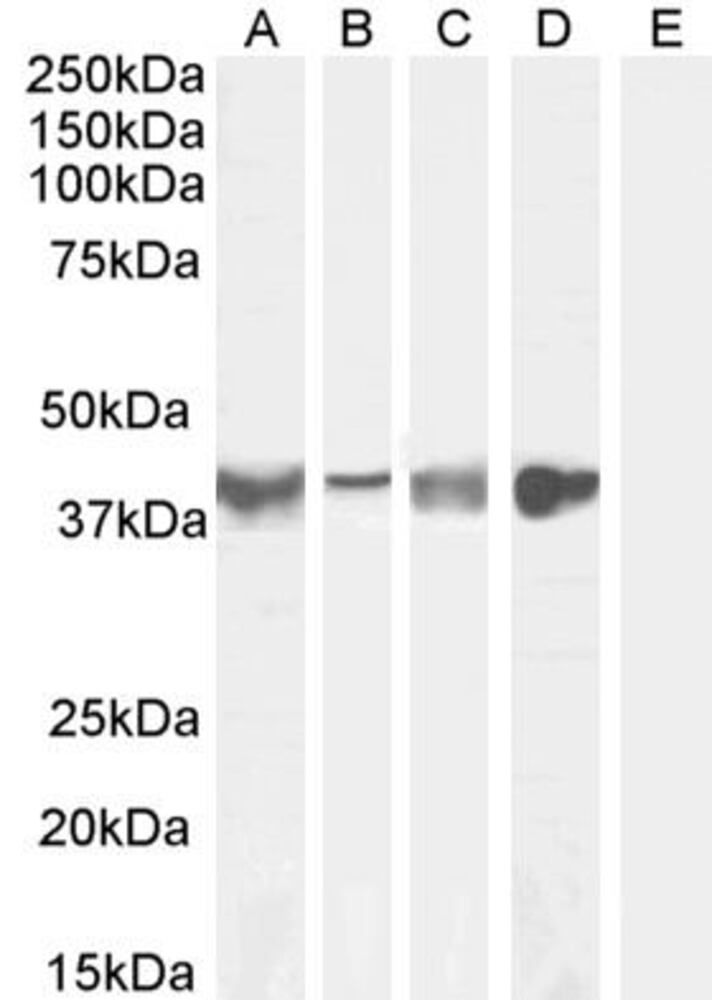 Anti-Asporin Antibody