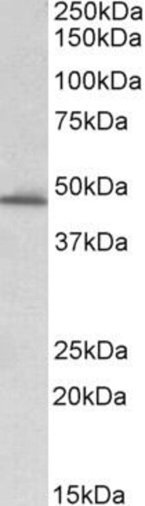 Anti-PAI1 Antibody, 100 µg