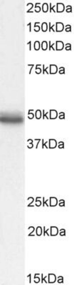 Anti-CCKBR Antibody, 100 µg