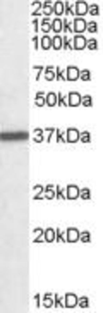 Anti-Liver Arginase Antibody, 100 µg
