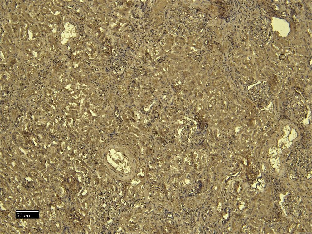 Anti-SDHB Antibody
