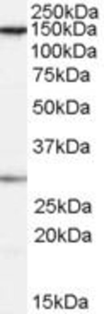 Anti-SUPT16H Antibody
