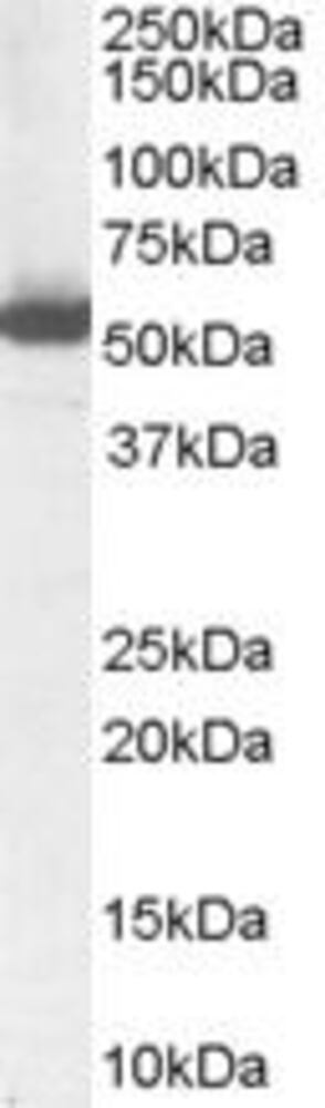 Anti-ALDH1A1 Antibody, 100 µg