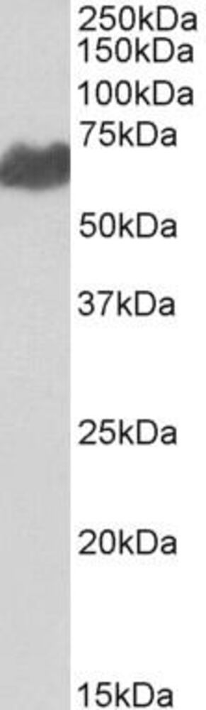 Anti-Melanoma gp100 Antibody, 100 µg